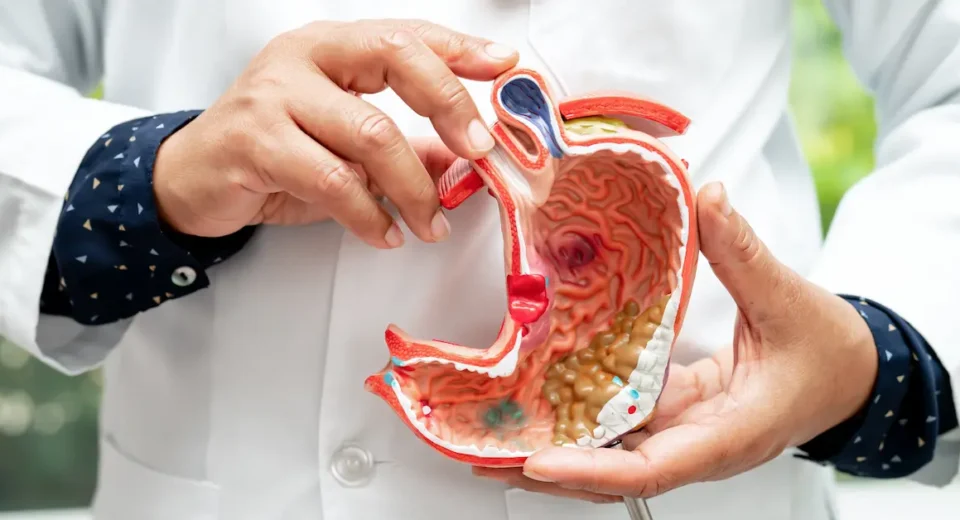 A doctor holding a 3D anatomical model of the human stomach, highlighting digestive health conditions and treatment options.