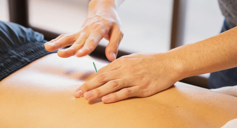 Acupuncture in Traditional Chinese Medicine