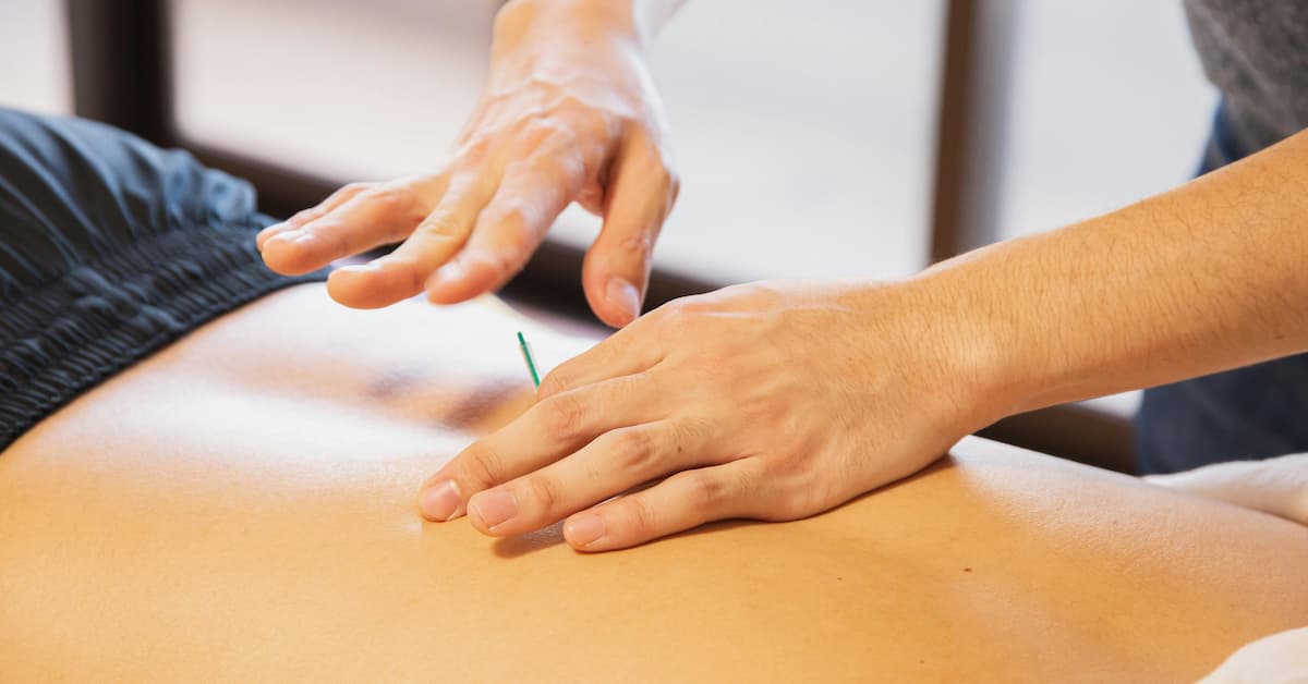 Acupuncture in Traditional Chinese Medicine