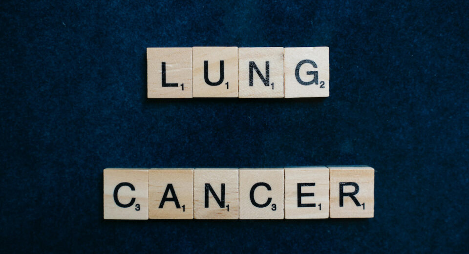 Malaysia Low-Dose CT for Lung Cancer | Affordable Screening for Smokers