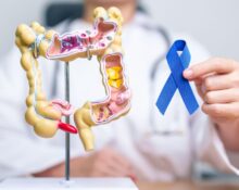 Best Colorectal Surgeon Singapore Editors List