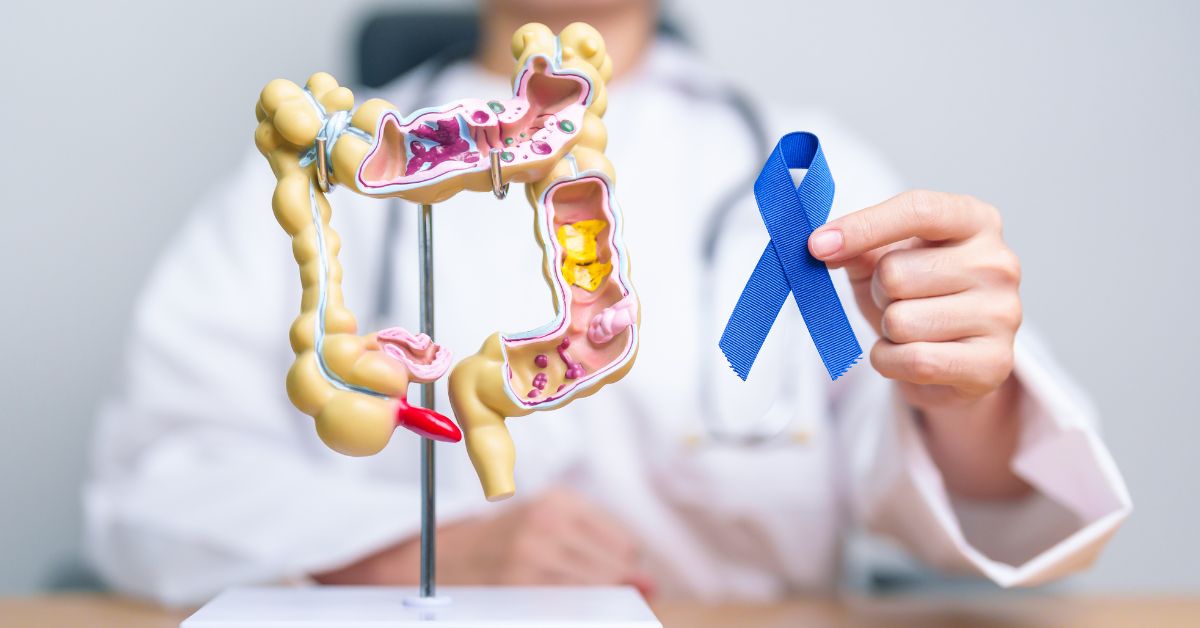 Best Colorectal Surgeon Singapore Editors List
