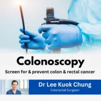 Dr Lee Kuok Chung (SG) – Colonoscopy