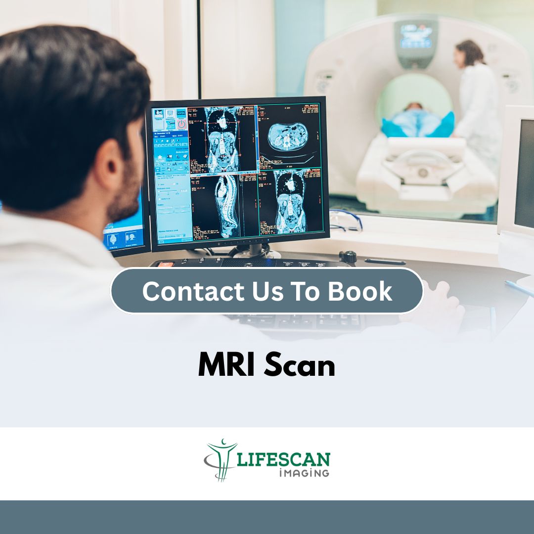 MRI Scan - Lifescan SKU