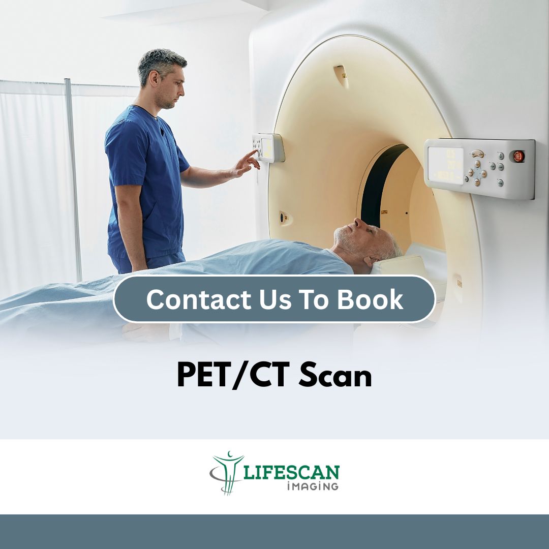 PET:CT Scan - Lifescan SKU