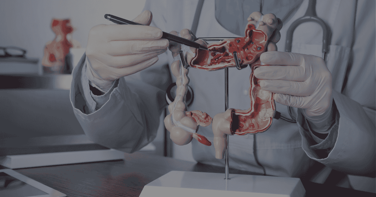 Your Guide to Prudential Panel Gastroenterologists in Mount Alvernia
