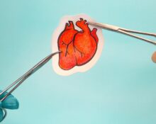 best cardiothoracic surgeon in Singapore
