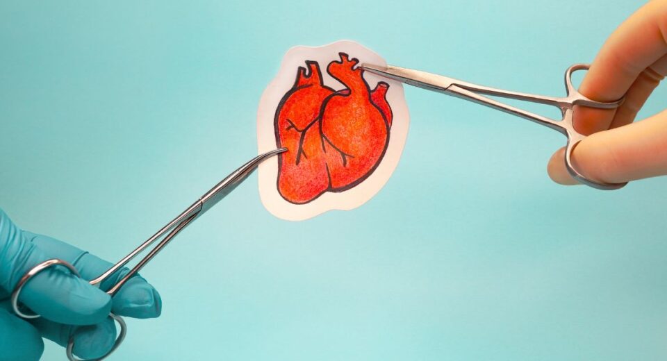 best cardiothoracic surgeon in Singapore