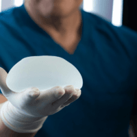 Breast Augmentation