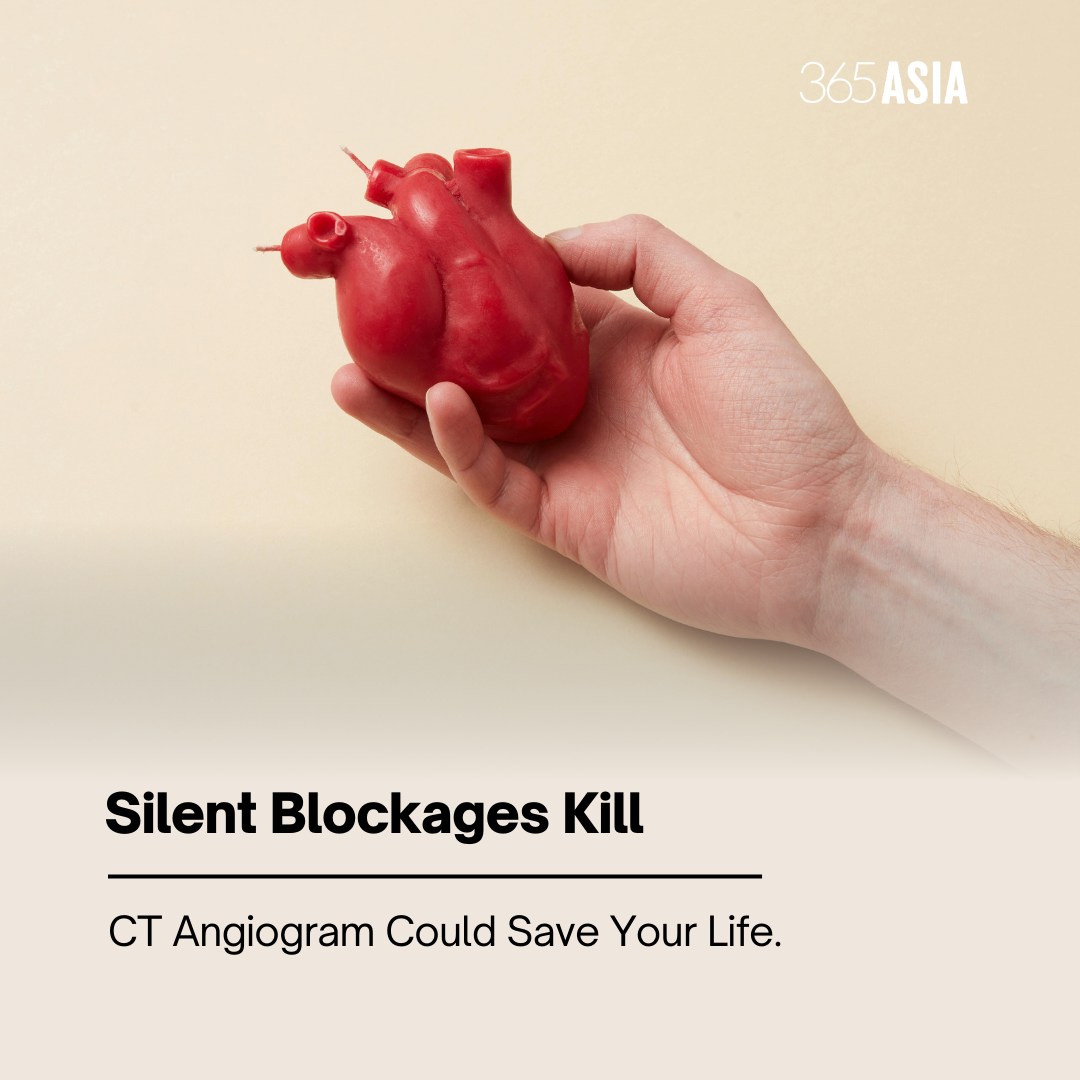 CT Angiogram