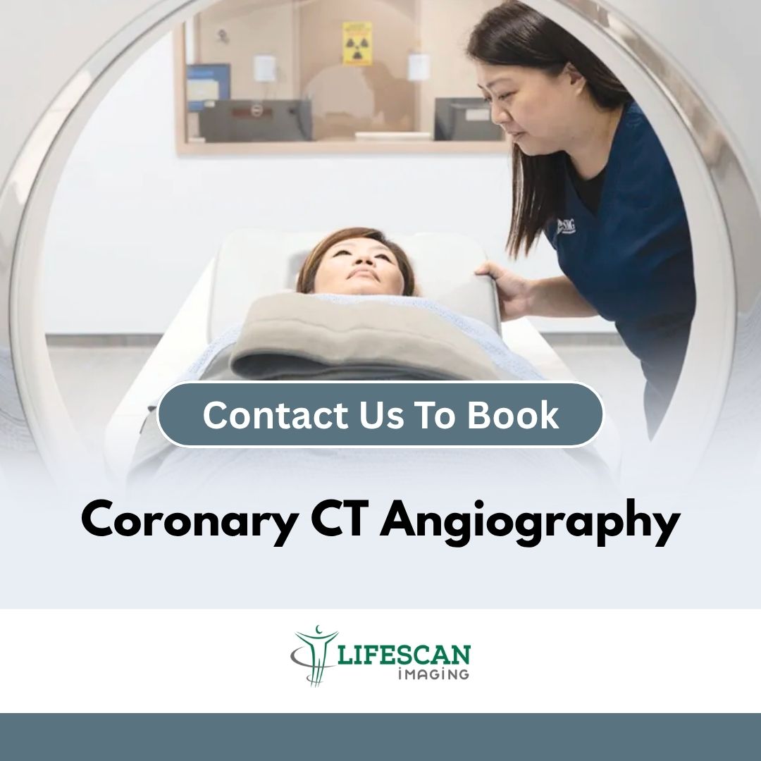 Coronary CT Angiography - Lifescan SKU
