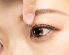 double eyelid surgery Singapore