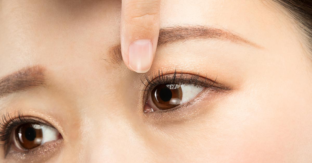 double eyelid surgery Singapore