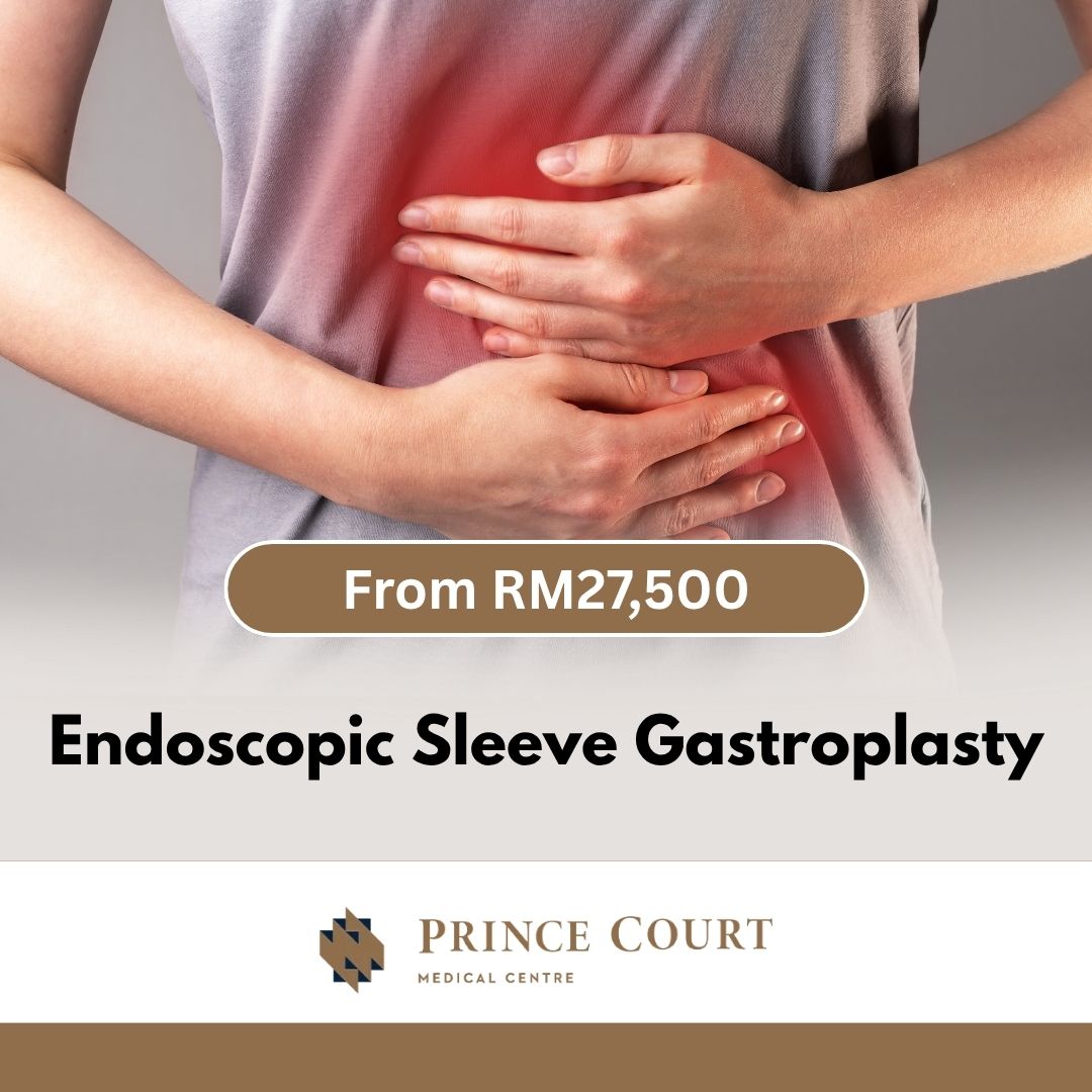 Endoscopic Sleeve Gastroscopy - Prince Court SKU