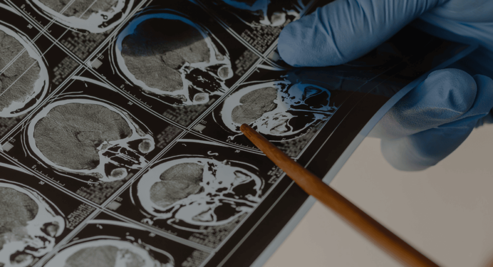 Prudential Panel Neurosurgeons in Singapore