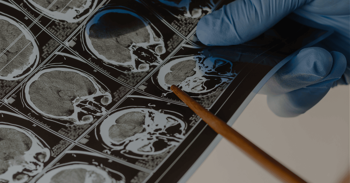 Prudential Panel Neurosurgeons in Singapore