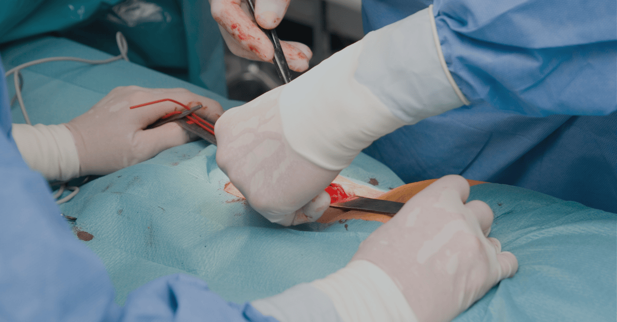 Prudential Panel Hernia Surgeons in Singapore
