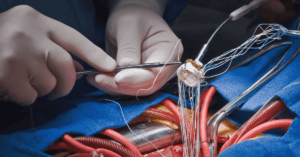 Singlife Panel Cardiologists in Mount Elizabeth Hospital