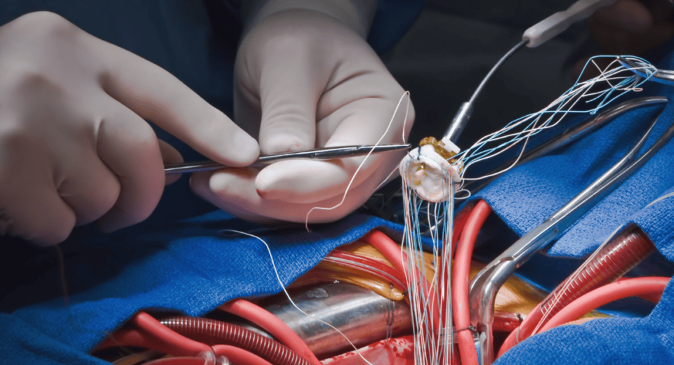 Singlife Panel Cardiologists in Mount Elizabeth Hospital