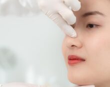Nose Bridge Plasty
