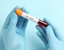STD testing Singapore