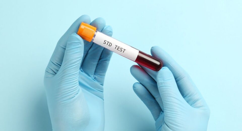 STD testing Singapore