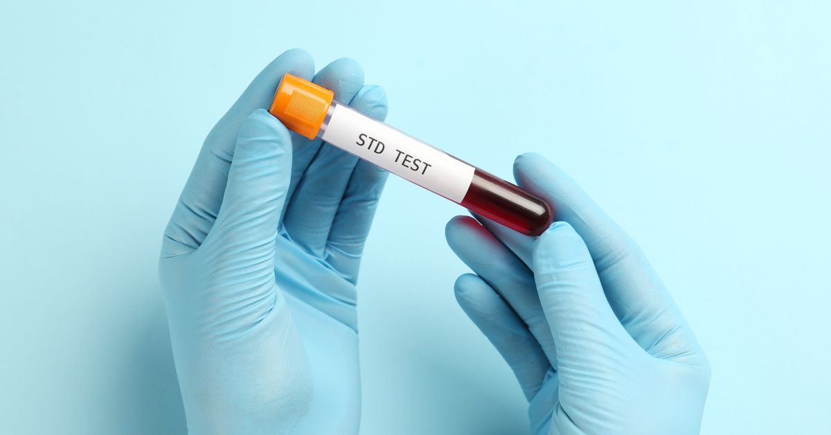 STD testing Singapore
