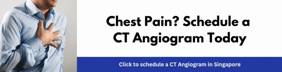 CT Angiogram 365Asia