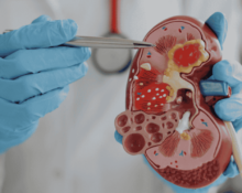 Prudential Panel Urologists in Mount Alvernia Hospital