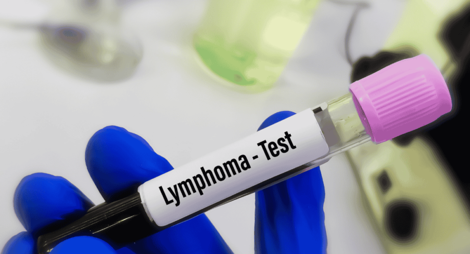Lymphoma Treatment Costs and Insurance Coverage in Singapore