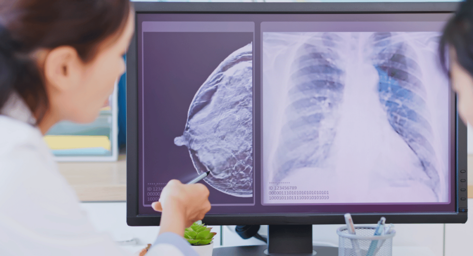 Breast Cancer Treatment Costs and Insurance Coverage in Singapore