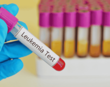 Leukemia Treatment Costs and Insurance Coverage in Singapore