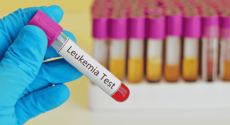 Leukemia Treatment Costs and Insurance Coverage in Singapore