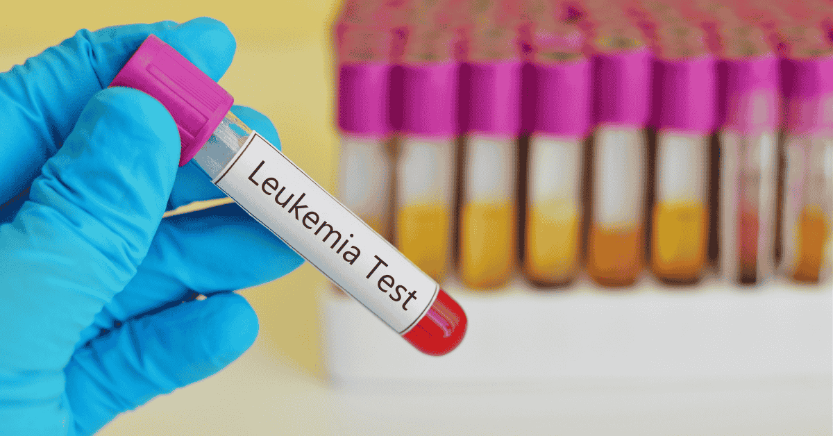 Leukemia Treatment Costs and Insurance Coverage in Singapore