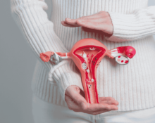 Cervical Cancer Treatment Costs and Insurance Coverage in Singapore