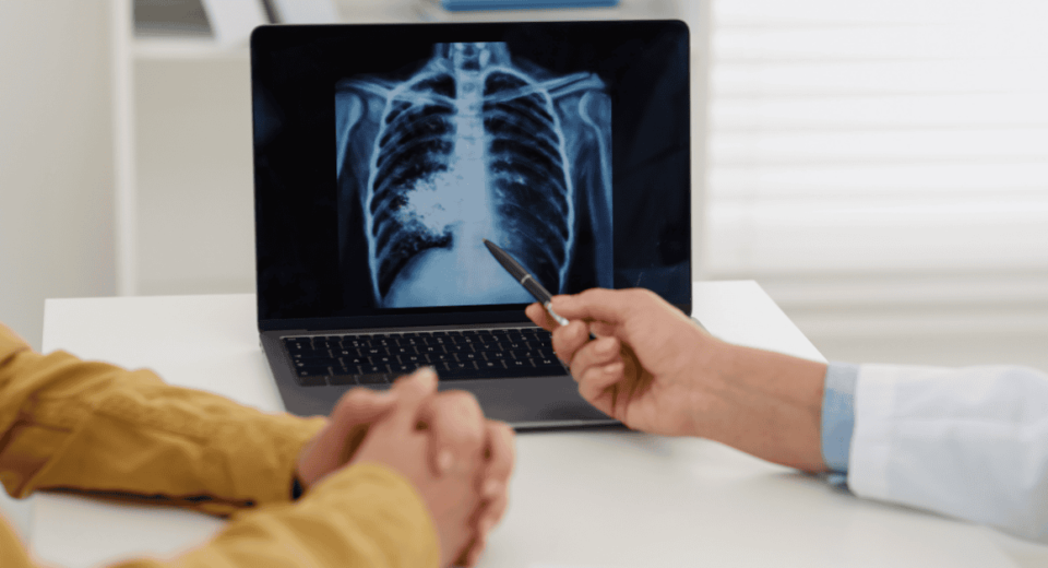 Lung Cancer Treatment Costs and Insurance Coverage in Singapore