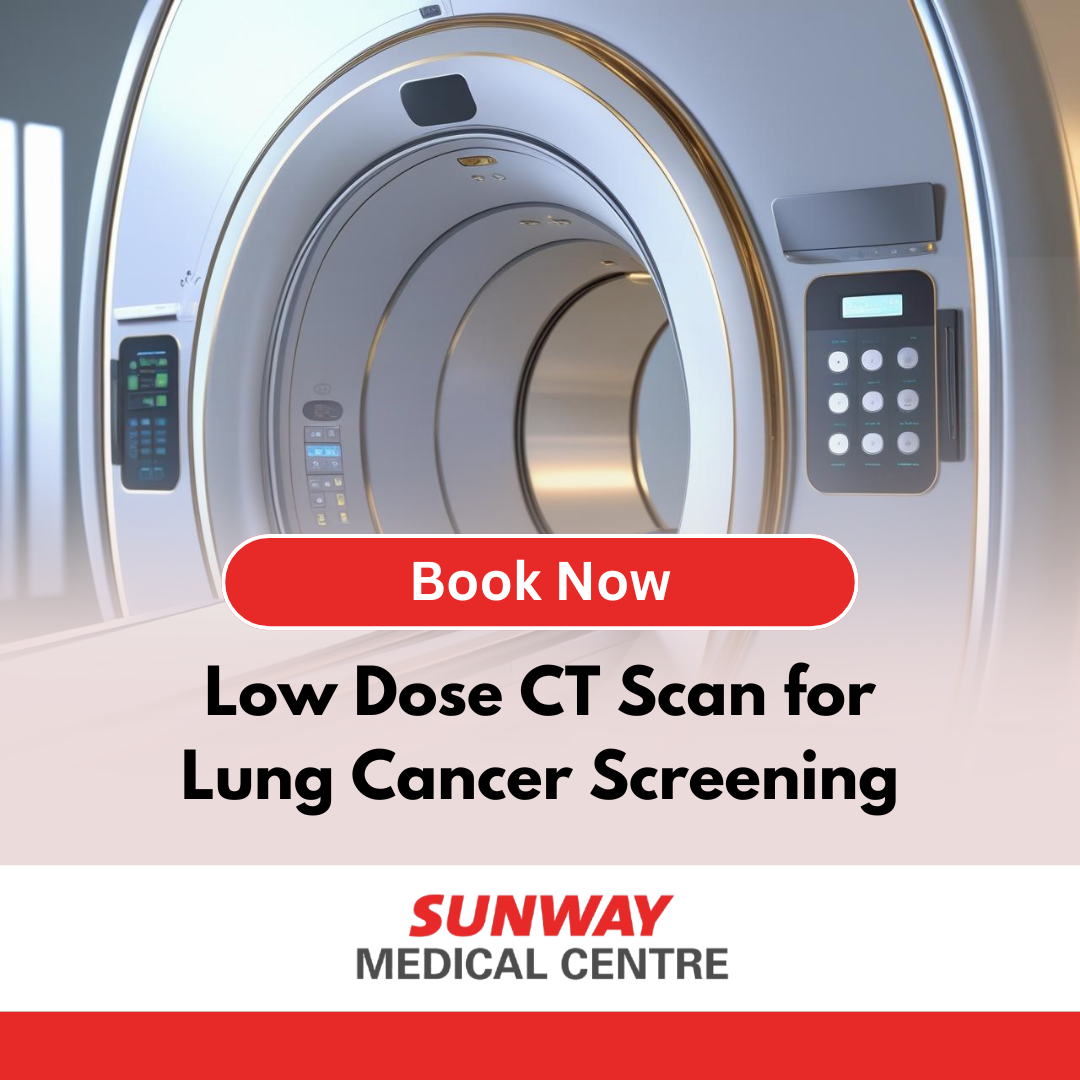 low dose ct scan