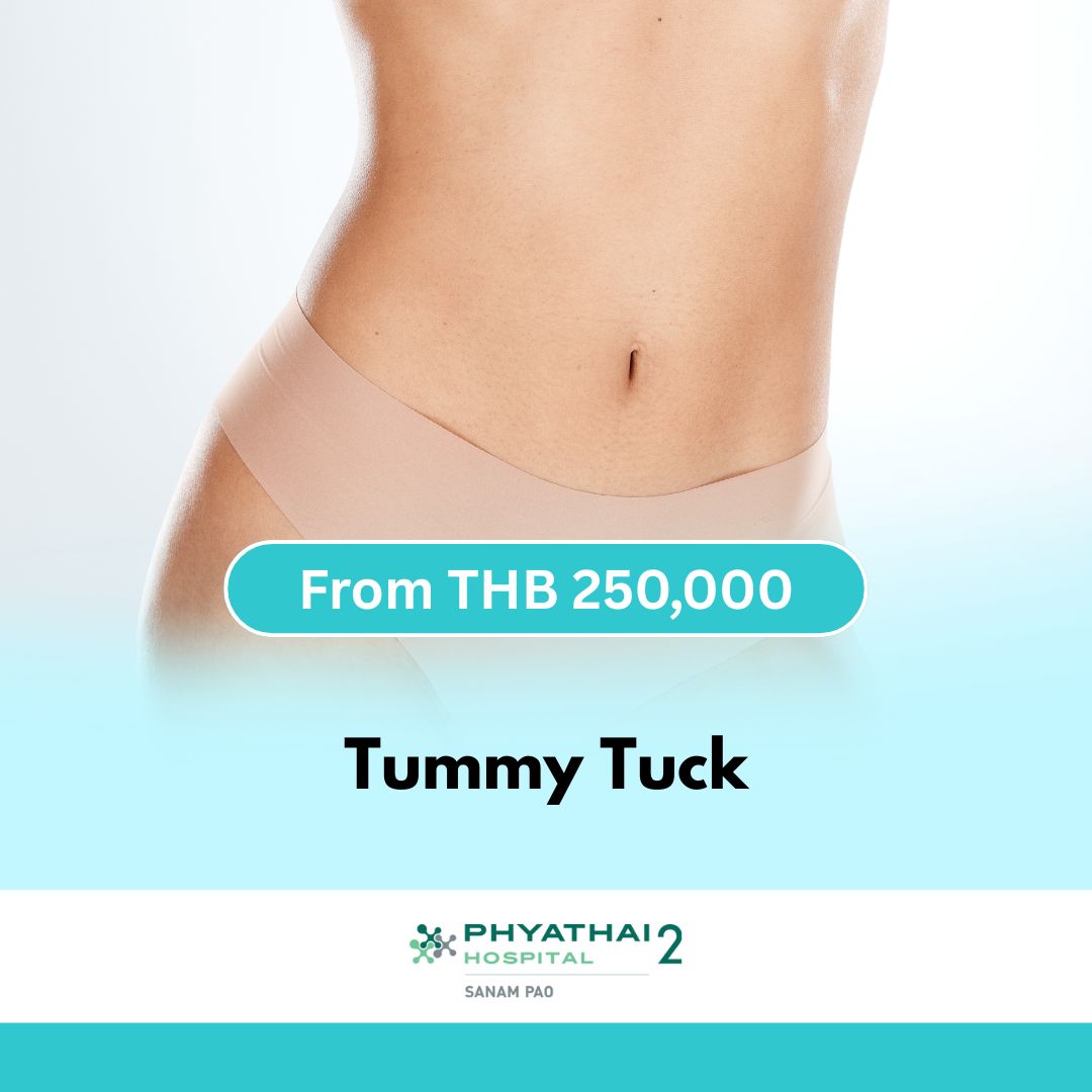 Tummy Tuck - Phyathai 2 SKU