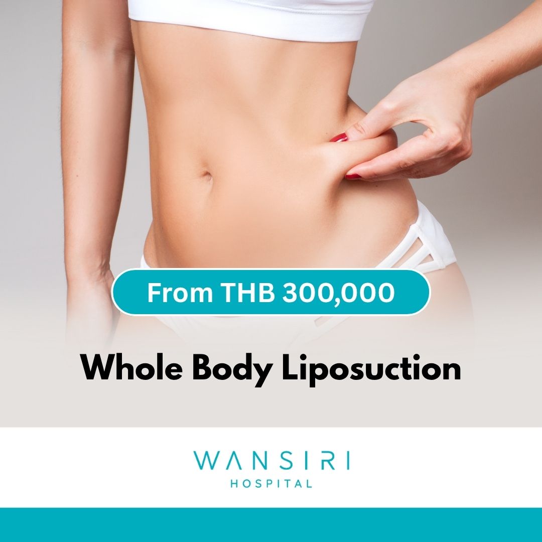 Whole Body Liposuction - Wansiri SKU