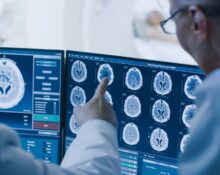 ct scan vs mri​