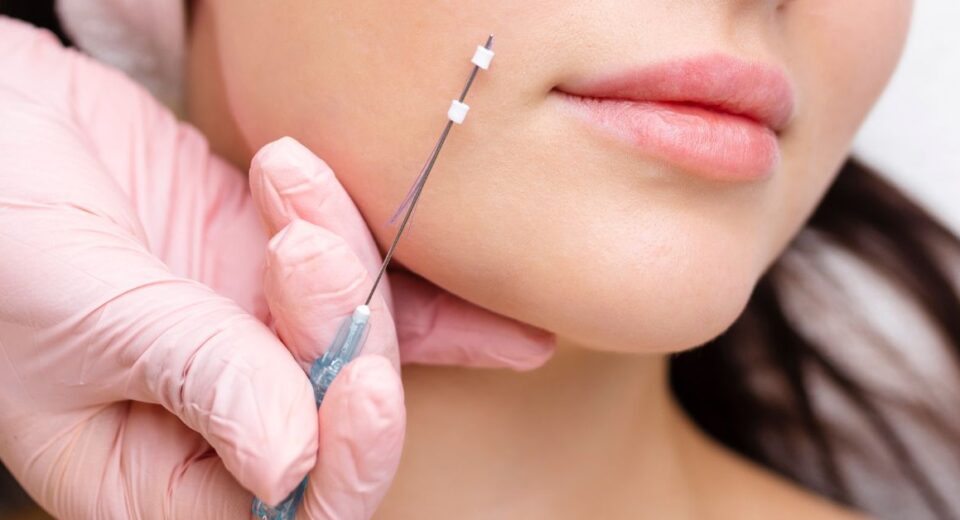 face lift thread singapore