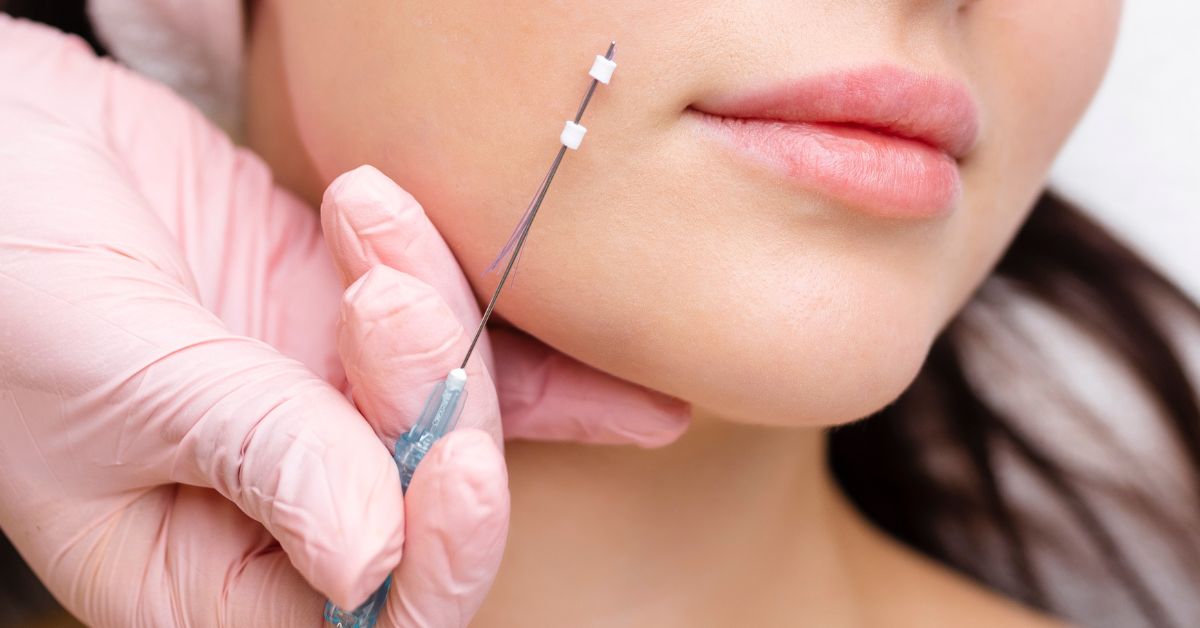 face lift thread singapore