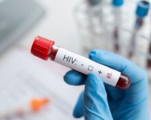 hiv test cost singapore
