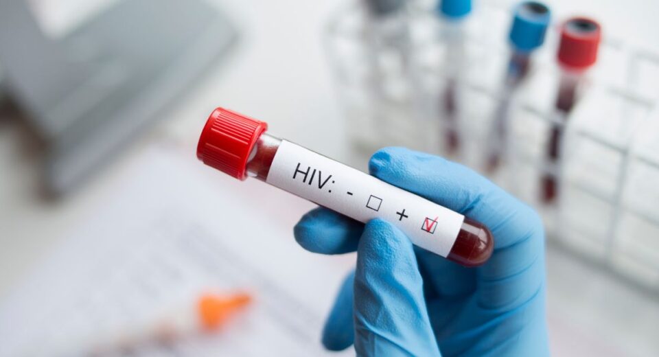 hiv test cost singapore
