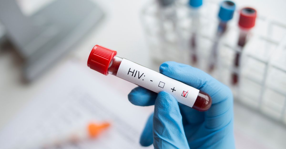 hiv test cost singapore