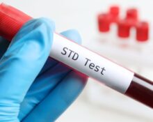 std test singapore