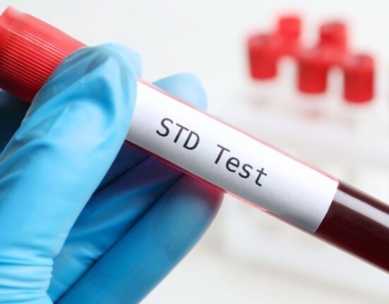 std test singapore