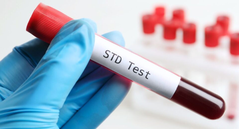 std test singapore