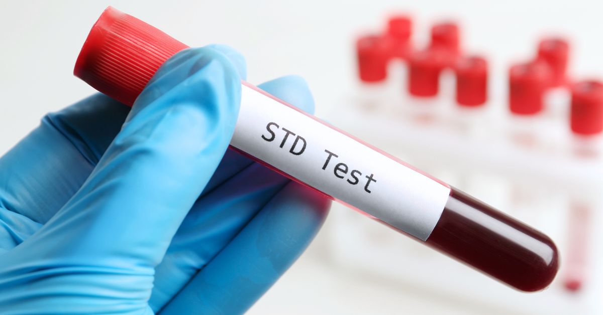 std test singapore