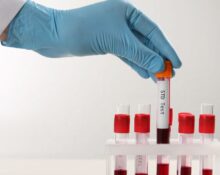 std testing